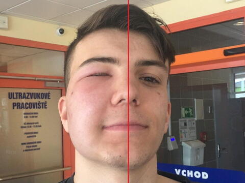 Portrét "pro pojišťovnu". Erik trénoval kick-box vedle včelých úlů. Co mohlo takovou včelku napadnout? Najděte 5 rozdílů. :-) (Erikův táta trénuje kromě svého syna taky Patrika Kincla. Karlos Vémola prý dopadl v pátek výrazně hůř. :-))